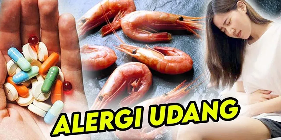 Cara mengobati alergi kepiting secara alami